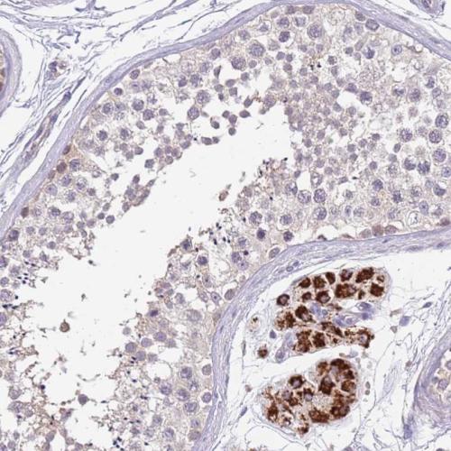 Immunohistochemical staining of human te
