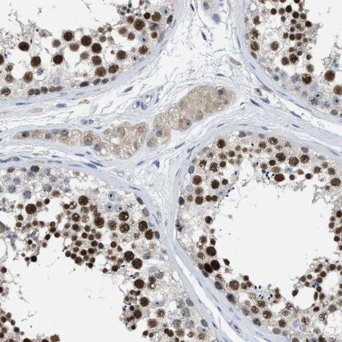 Immunohistochemical staining of human te