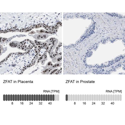 Immunohistochemistry analysis in human p