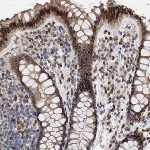 Immunohistochemical staining of human co