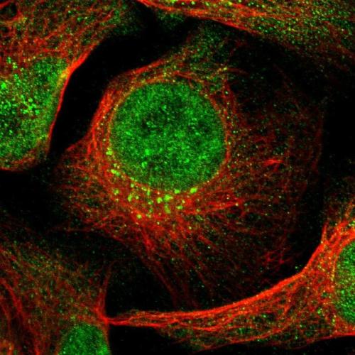 Immunofluorescent staining of human cell