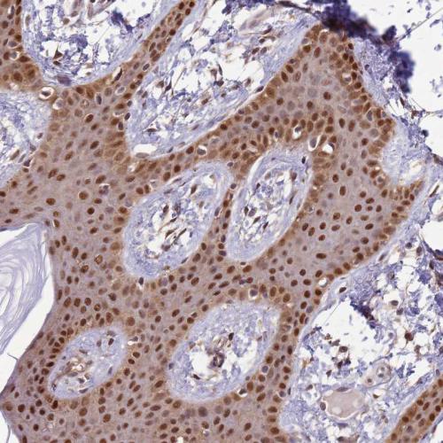 Immunohistochemical staining of human sk