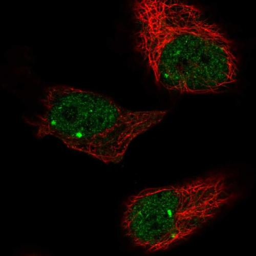 Immunofluorescent staining of human cell