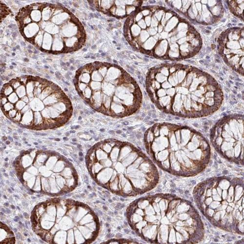 Immunohistochemical staining of human co