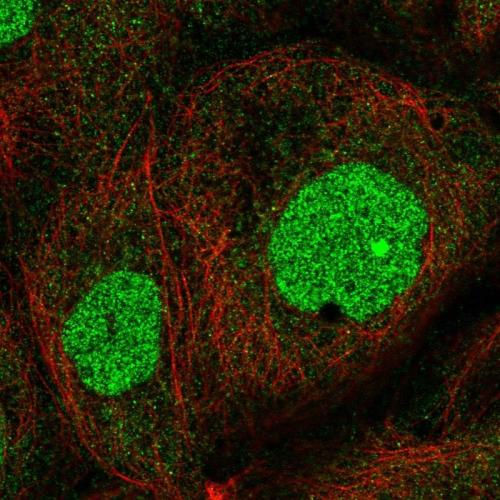 Immunofluorescent staining of human cell