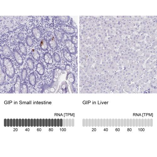 Immunohistochemistry analysis in human s