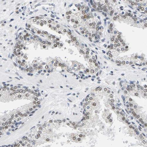 Immunohistochemical staining of human pr