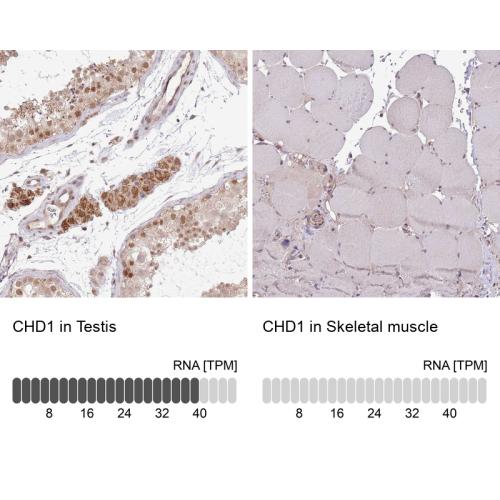 Immunohistochemistry analysis in human t