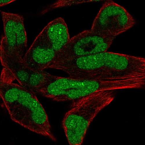 Immunofluorescent staining of human cell