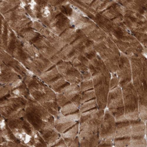 Immunohistochemical staining of human sk