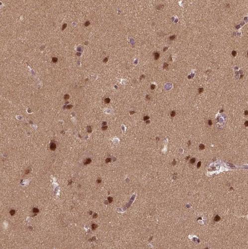 Immunohistochemical staining of human Ce