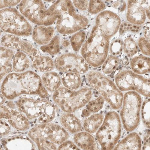 Immunohistochemical staining of human ki