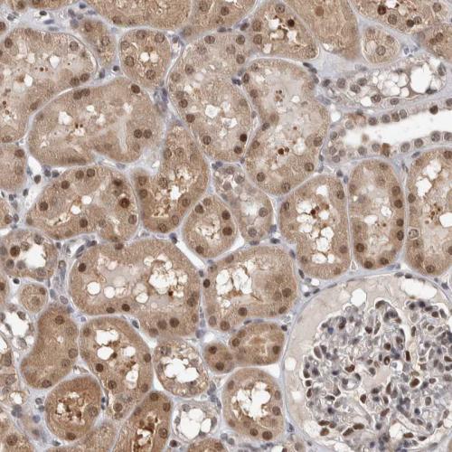 Immunohistochemical staining of human ki