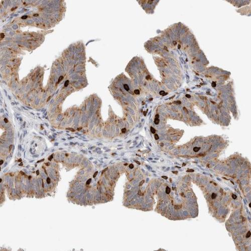 Immunohistochemical staining of human ly