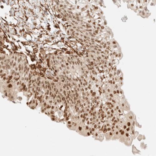 Immunohistochemical staining of human ur