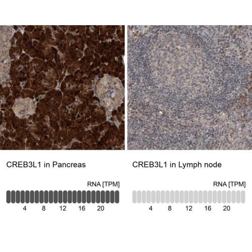 Immunohistochemistry analysis in human p