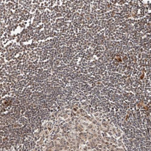 Immunohistochemical staining of human ly