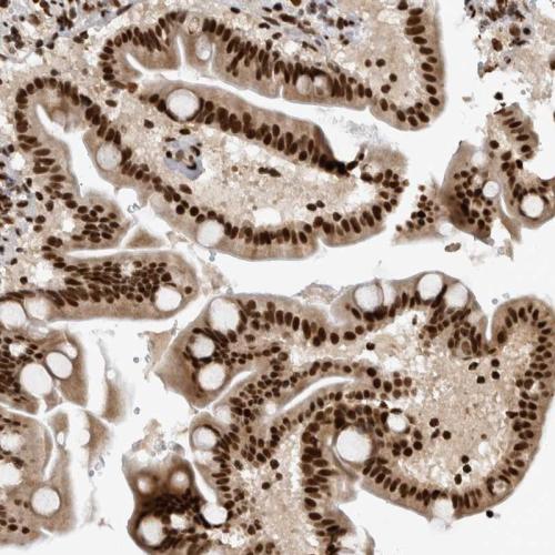 Immunohistochemical staining of human du