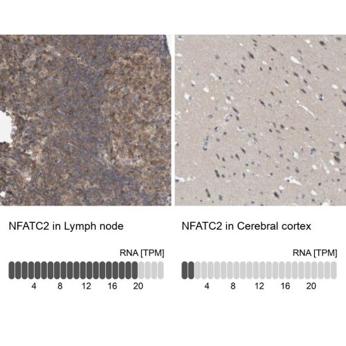 Immunohistochemistry analysis in human l