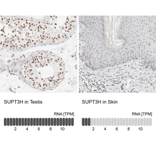 Immunohistochemistry analysis in human t