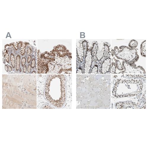 Immunohistochemical staining of human co