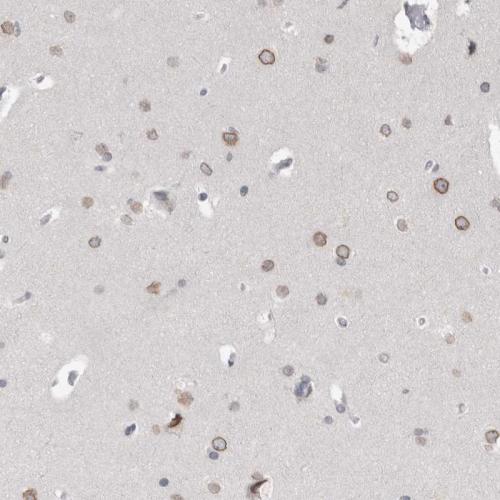 Immunohistochemical staining of human ce