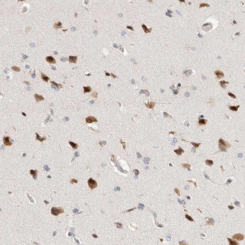 Immunohistochemical staining of human ce