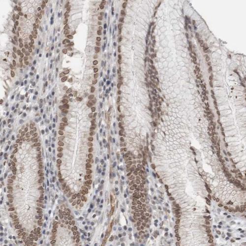 Immunohistochemical staining of human st