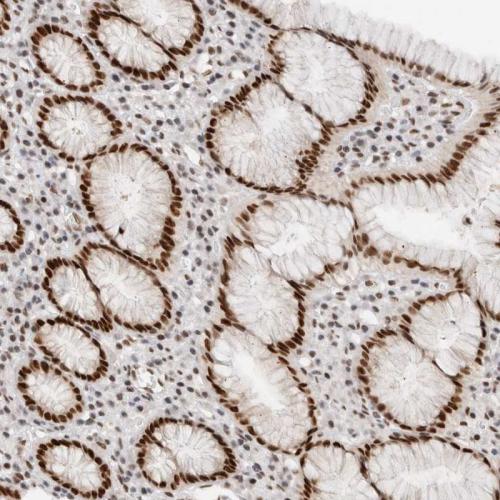 Immunohistochemical staining of human st