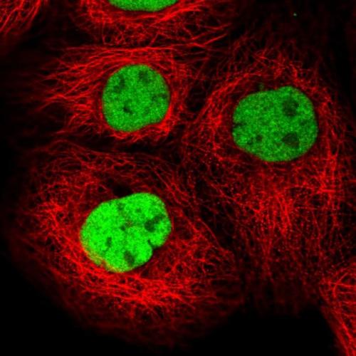 Immunofluorescent staining of human cell
