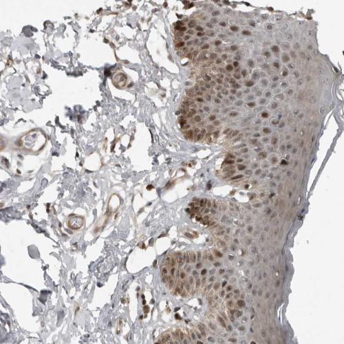Immunohistochemical staining of human sk
