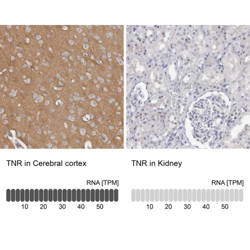 Immunohistochemistry analysis in human c