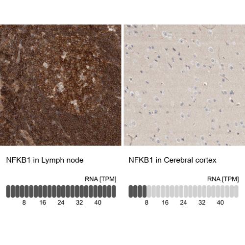 Immunohistochemistry analysis in human l