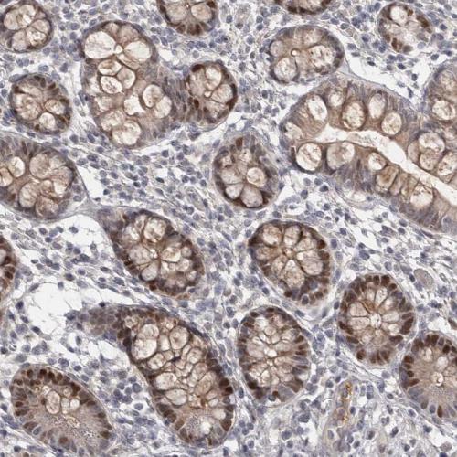 Immunohistochemical staining of human sm