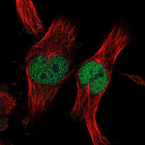 Immunofluorescent staining of human cell