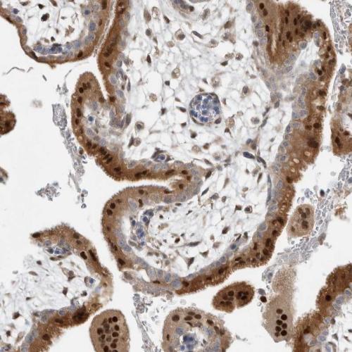 Immunohistochemical staining of human pl