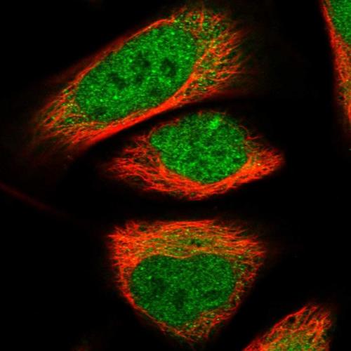 Immunofluorescent staining of human cell