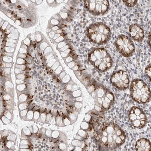 Immunohistochemical staining of human sm