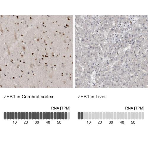 Immunohistochemistry analysis in human c