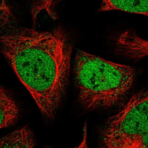 Immunofluorescent staining of human cell