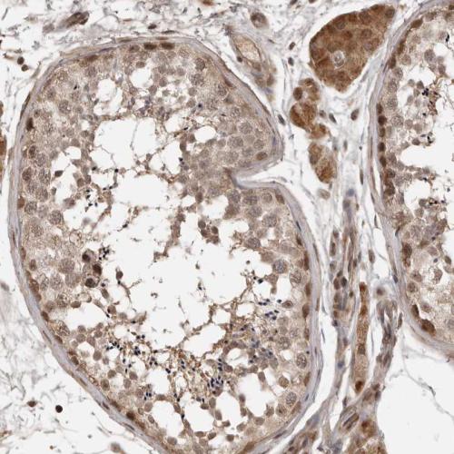 Immunohistochemical staining of human te