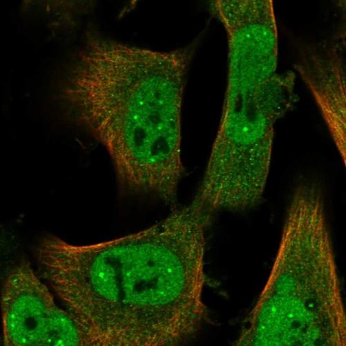 Immunofluorescent staining of human cell