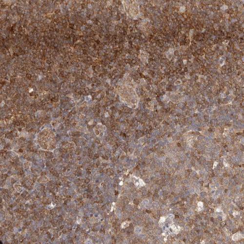 Immunohistochemical staining of human ly