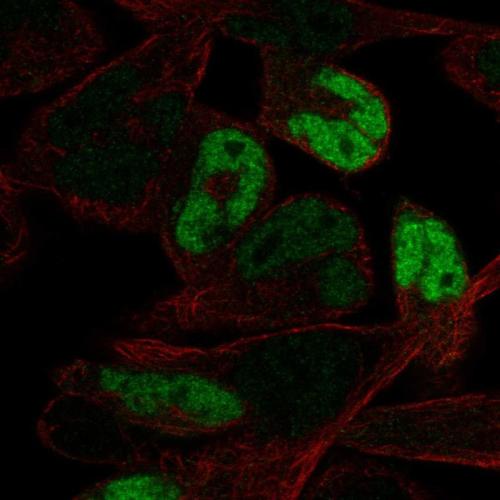 Immunofluorescent staining of human cell