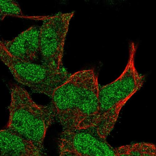Immunofluorescent staining of human cell