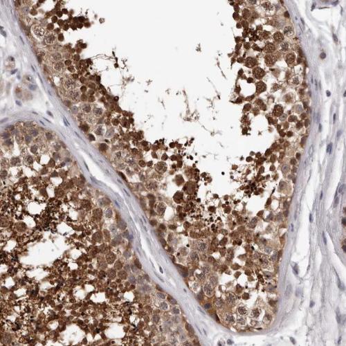 Immunohistochemical staining of human te