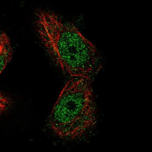Immunofluorescent staining of human cell