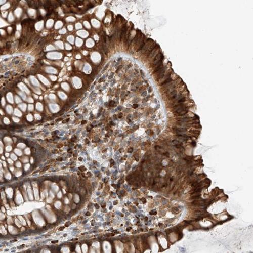 Immunohistochemical staining of human co
