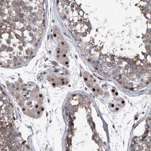 Immunohistochemical staining of human te