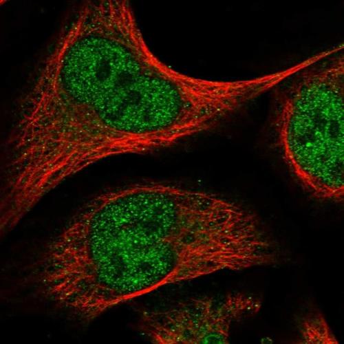 Immunofluorescent staining of human cell